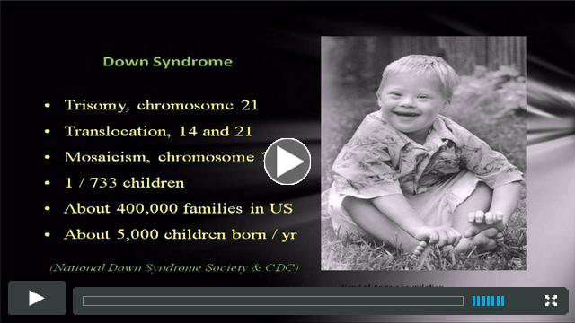 Watch an informative presentation on the ethics of prenatal testing which features Dr. Brian Skotko, Patricia Bauer and Mark Leach.