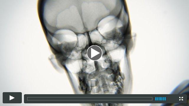 X-ray Body in Motion - Yoga