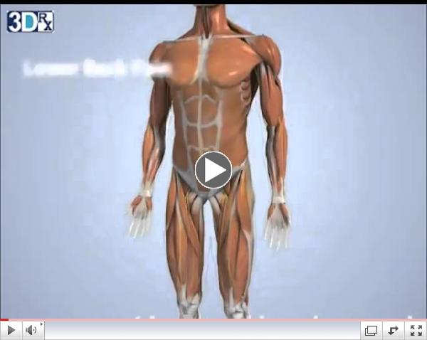 Spondylolisthesis