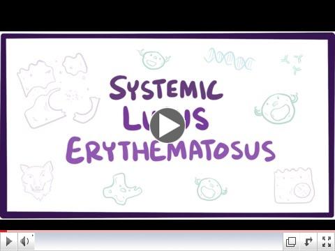 Systemic lupus erythematosus (SLE) - causes, symptoms, diagnosis & pathology