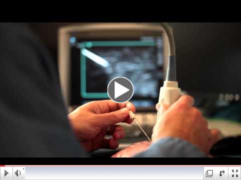 Advanced Needle Visualization for Primary Care - SonoSite Ultrasound