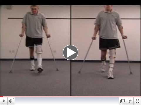  Stance Control KAFO vs. Locked Knee KAFO