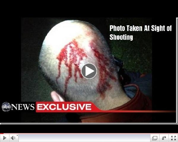 Zimmerman Trial Indicates KKK Style Racist Injustice in Courts is Still with Us, Media is Culprit