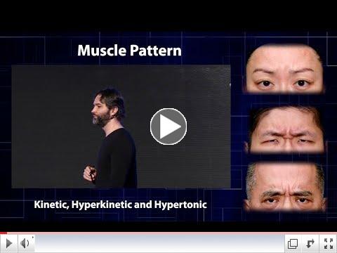 Which facial muscle type do you have?