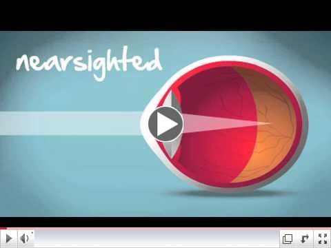 Understanding Myopia, Hyperopia & Astigmatism