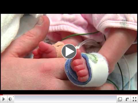 Ooutcomes of very small preterm infants