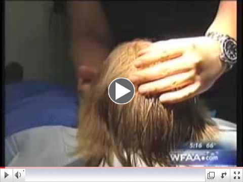 Hair Transplant and Hair Loss in Women, News Segment ABC