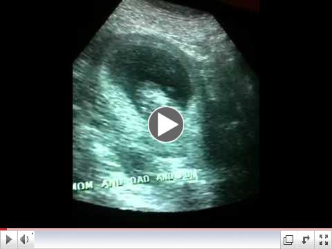 Amy McManus' pre-natal visit at 11 weeks, 4 days of pregnancy