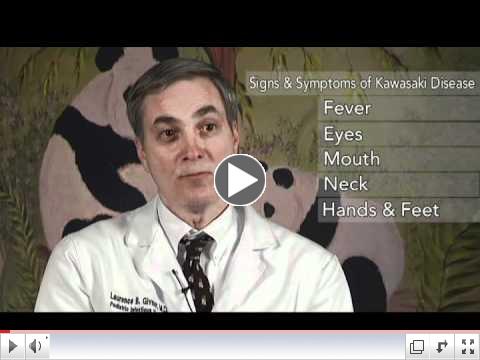 Signs & Symptoms of Kawasaki Disease