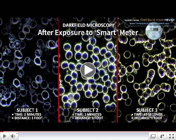 Smart Meters: Evidence Of Adverse Health Effects