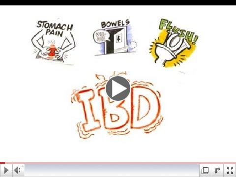 Inflammatory Bowel Disease (IBD)