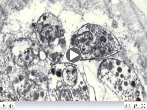 Toxoplasmosis & Toxoplasma gondii
