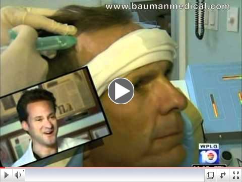 Ouchless Hair Transplant _ Dr. Alan Bauman