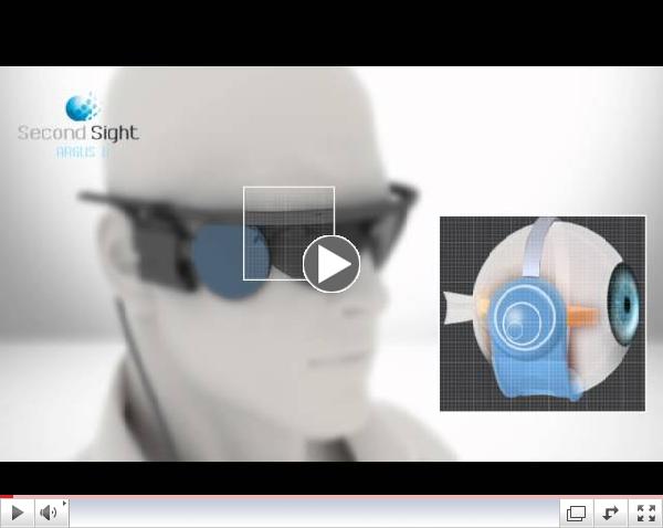 Second Sight EN 2012 Argus II Retinal Prosthesis System Artificial Retina Bionic Eye