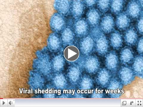 Norovirus