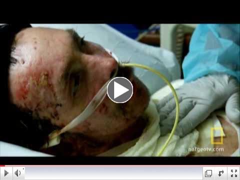 Meth Lab Explosion
