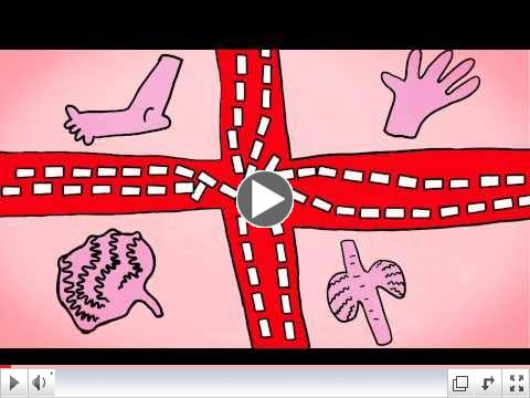 What is Atrial Fibrillation