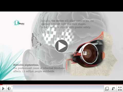 Bionic Eye - Animation