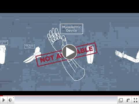 Prosthetics are not a luxury #NotALuxury