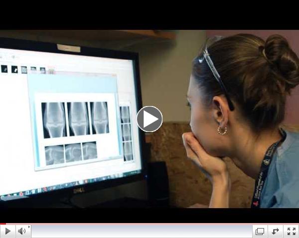 Detecting and Treating Arthritis
