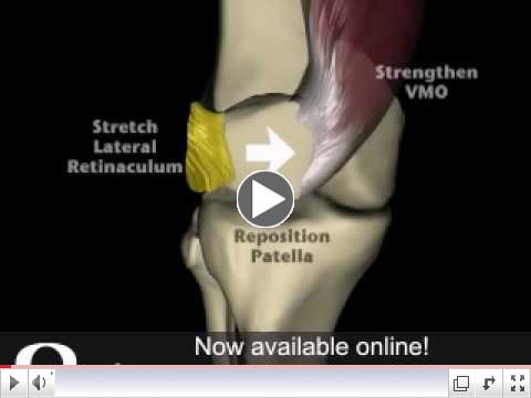 Patella Femerol Pain