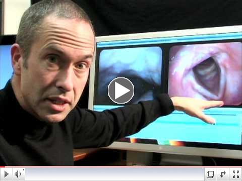 Laryngoscopy the art of seeing the voice (vocal cords)