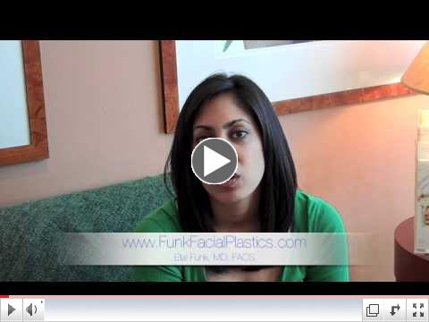 Rhinoplasty (Nose Surgery) Patient in Houston, TX - Funk Facial Plastic Surgery, Etai Funk, MD, FACS