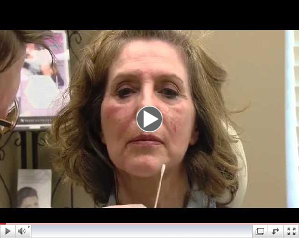 Non-Surgical Facelift on Utah's Younger You with Troy Thompson