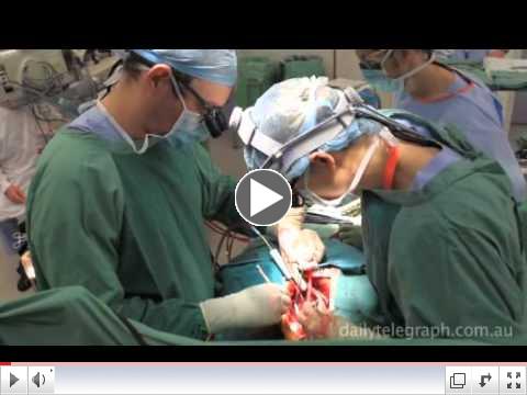 Heart transplant surgery