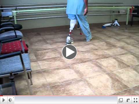 Left BKA Amputee Patient Demonstration Talux Foot: Spears P&O-Memphis