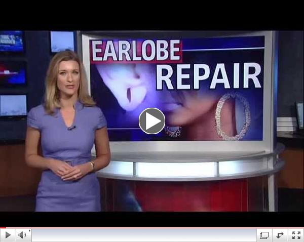 Earlobe Repair in Houston TX