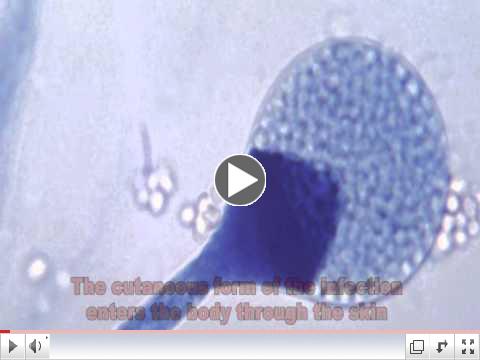 Mucor and Mucormycosis