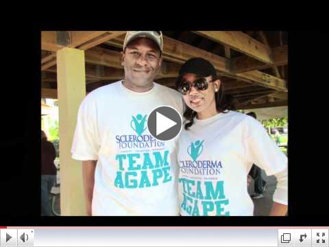 Why Do You Walk for Scleroderma?