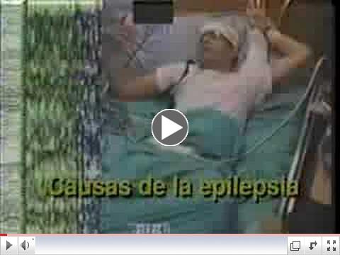 Epilepsia 1