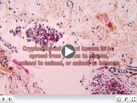 Cryptococcus Fungi: The Cause of Cryptococcosis