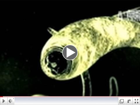 Monsters Inside Me: Really Bad Sushi