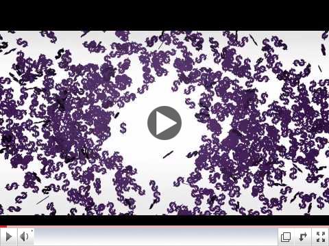 2011 Alzheimer's Facts and Figures