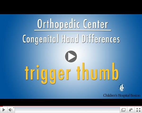 trigger thumb - congenital hand differences - Children's Hospital Boston