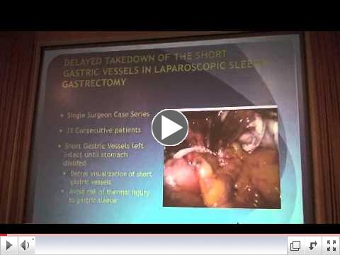 Gastric Sleeve Safety Technique