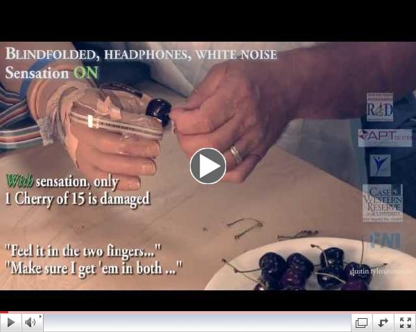 Restoring Natural Human Sensation in Amputees