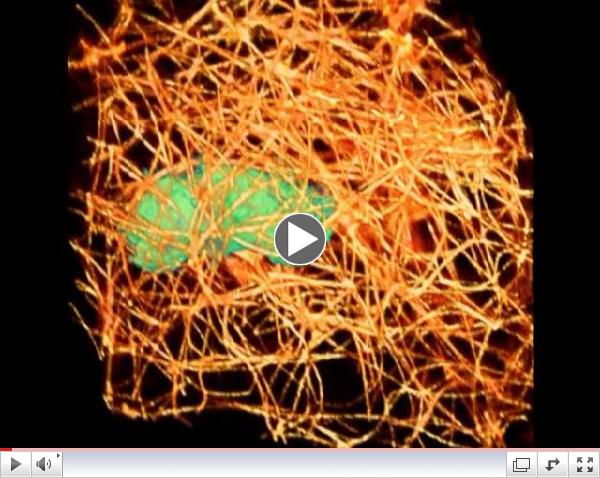 Cancer-cell squeeze | Science News