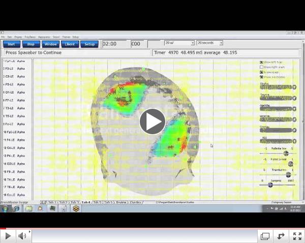 BrainAvatar by BrainMaster