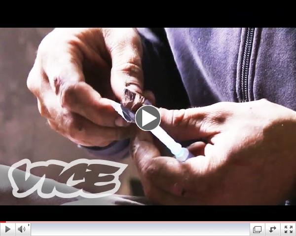 Krokodil: Russia's Deadliest Drug (NSFW)