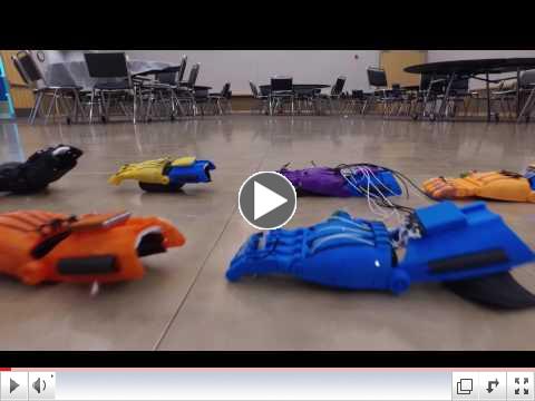 Bionic Hands for kids who need a hand.