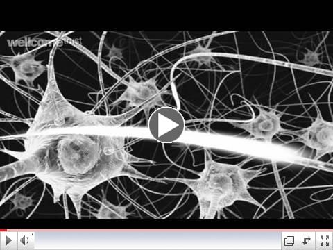 Motor neurone disease - The Neurodegenerative Diseases Initiative | A film by the Wellcome Trust