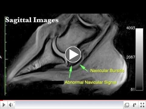 Standing MRI Information