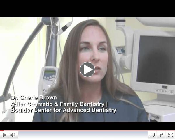 Cherie Brown DDS MS | Adler Dentistry | BCAD | Boulder, Colorado